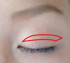 重瞼線に沿った全切開の位置