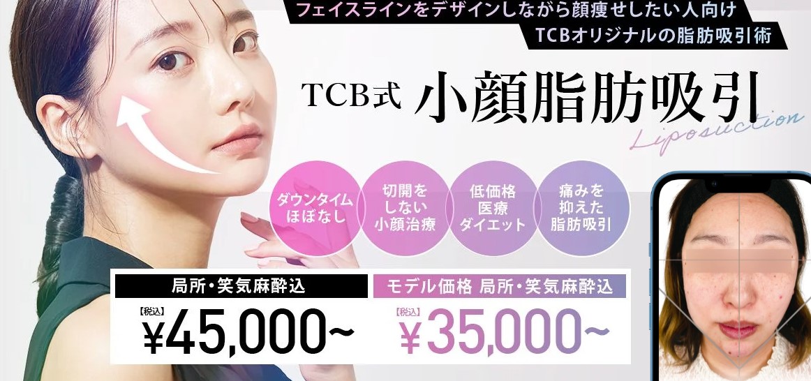 TCB東京中央美容外科　小顔脂肪吸引