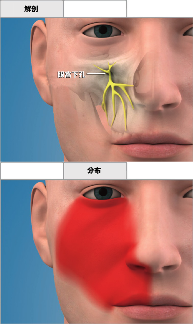 眼窩下神経ブロック麻酔の範囲
